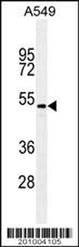 TGFB2 Antibody