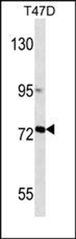 MMP2 Antibody