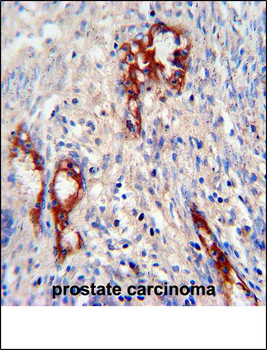 MMP2 Antibody