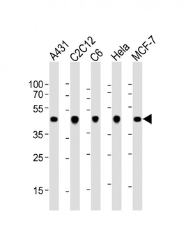 Beta-Actin Antibody