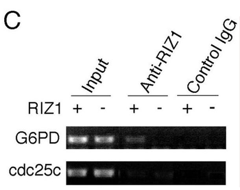 PRDM2 (RIZ1) Antibody
