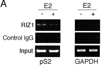 PRDM2 (RIZ1) Antibody