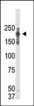 PRDM2 (RIZ1) Antibody