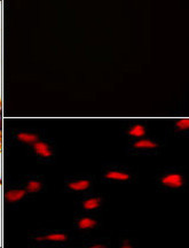 SET07 Antibody