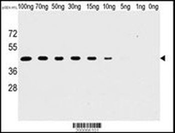 H1L Antibody