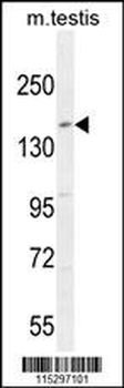 KIT Antibody (N-term D121)