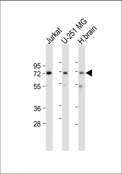 CAMK2G (CAMK2 gamma) Antibody (C-term)