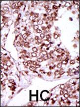 CAMK2G (CAMK2 gamma) Antibody (C-term)