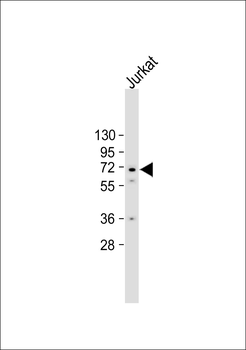 CAMK2G (CAMK2 gamma) Antibody (C-term)