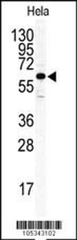 ILK2/ILK1 Antibody (C-term)