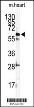 ILK2/ILK1 Antibody (C-term)