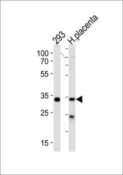 STUB1 Antibody (C-term)