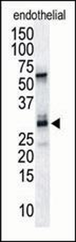 DSCR1 Antibody (C-term)