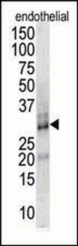 DSCR1 Antibody (Center)