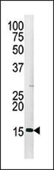 Phospho-H3(S28) Antibody