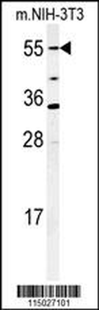 CYP26A1 Antibody (C-term)