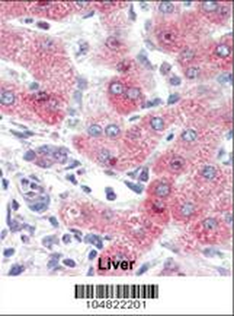 SYVN1 (HRD1) Antibody (C-term)