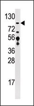 VDU1 Antibody (C-term)