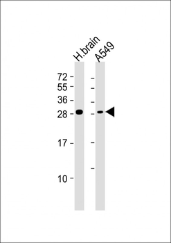 ASCL1 (Achaete-scute homolog 1) Antibody (C-term D220)