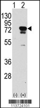 EIF4B Antibody (S422)