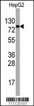 EIF4B Antibody (Center)