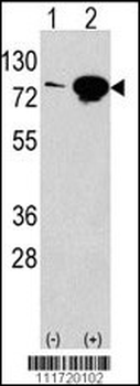 EIF4B Antibody (Center)