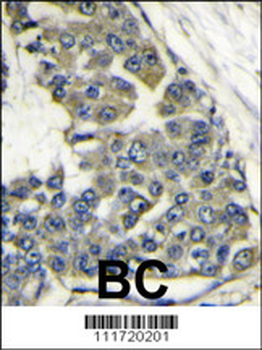EIF4B Antibody (Center)