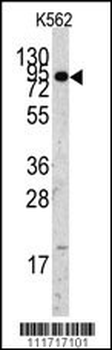 EIF4B Antibody (C-term)