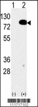 EIF4B Antibody (C-term)