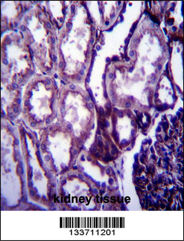 IGF1 Antibody (C-term)