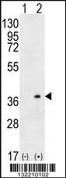 HLA-DQA1 Antibody (N-term)