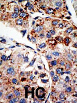 KMT4 / Dot1L Antibody (C-Term)