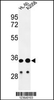 IGH Antibody (C-Term)