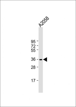 IGH Antibody (C-Term)