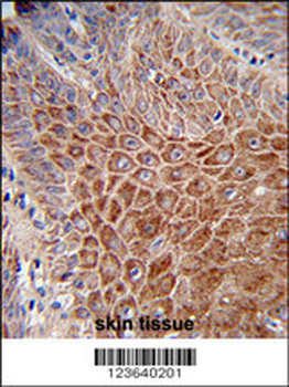 IGH Antibody (C-Term)