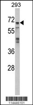 MAPK4 Antibody (N-term)