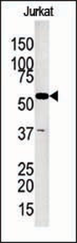 Glycerol kinase (GPK2) Antibody (C-term)