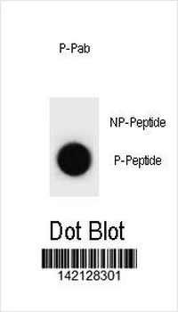 Phospho-mouse p21Cip1(S78) Antibody