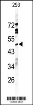 HRH4 Antibody (C-term)