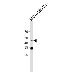 MEK1(S218/222) Antibody