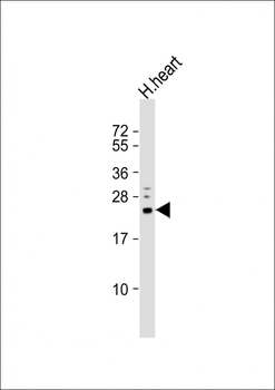 GSTK1 Antibody (N-term)