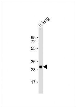 SULT1A1 Antibody (Center)