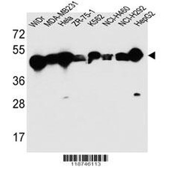 CYK18 Antibody (C-term)