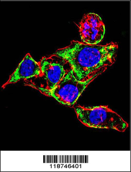 CYK18 Antibody (C-term)