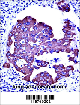 CYK18 Antibody (C-term)