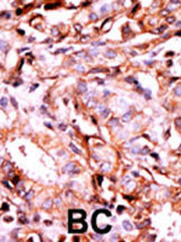 Phospho-BACE(S498) Antibody