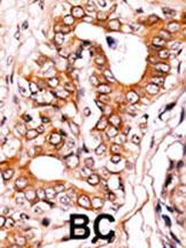 Phospho-ABL1(Y272) Antibody