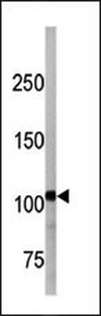 Bi-Phospho-LLGL1/2(S653/S649) Antibody