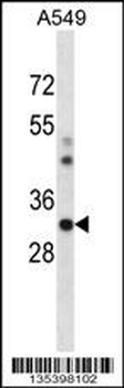 Mouse Csnk1a1 Antibody (C-term)