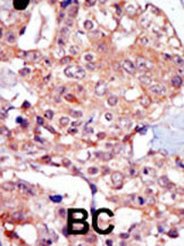 TRPM7 (CHAK1) Antibody (N-term)
